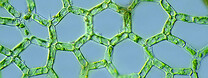 Hydrodictyon Foto: Antonio Guill�n / Flickr.com