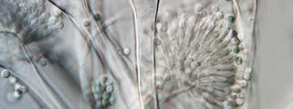 Vědci zjednodušili systém dělení druhů parazitické houby aspergilus Foto: Mikrobiologický ústav AV ČR / AV ČR Vědci zjednodušili systém dělení druhů parazitické houby aspergilus Foto: Mikrobiologický ústav AV ČR / AV ČR