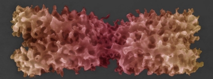 Kolorovaný snímek chromozomu v nativním stavu získané pomocí nově vyvinuté pokročilé environmentální rastrovací elektronová mikroskopie. Foto: ÚPT AV ČR