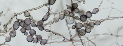 Houba Thalassodendromyces purpureus Foto: M. Vohník Botanický ústav AV ČR