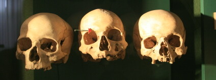 Středověké lebky v antropologické expozici Národního muzea v Praze. Foto: Jan Rybář / Ekolist.cz